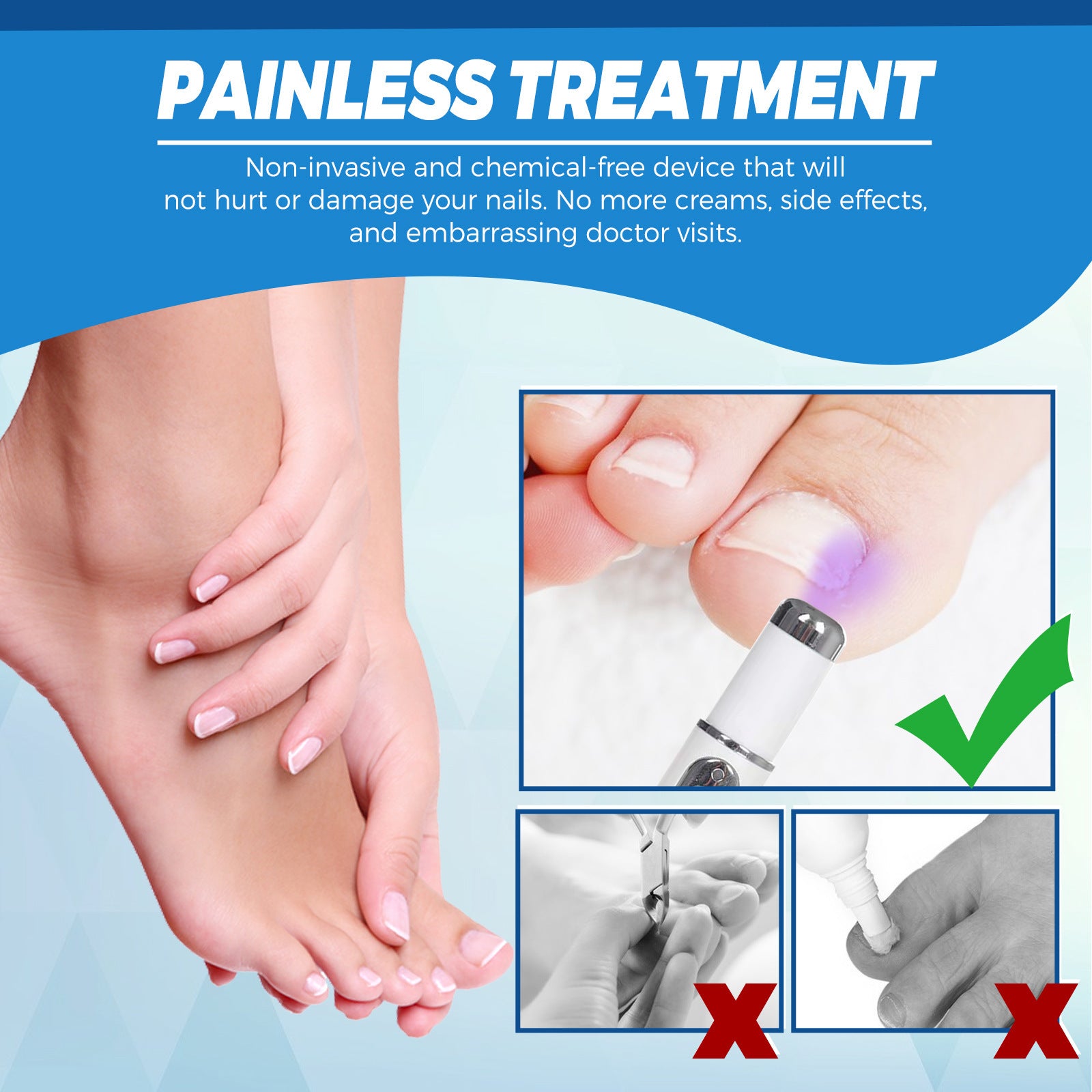 Onychomycosis Repair Laser Pen