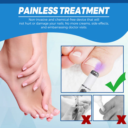 Onychomycosis Repair Laser Pen