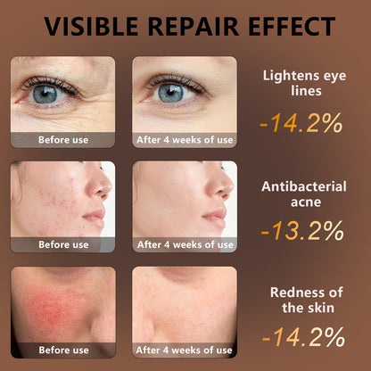 Photon Skin Rejuvenation Beauty Mask Instrument