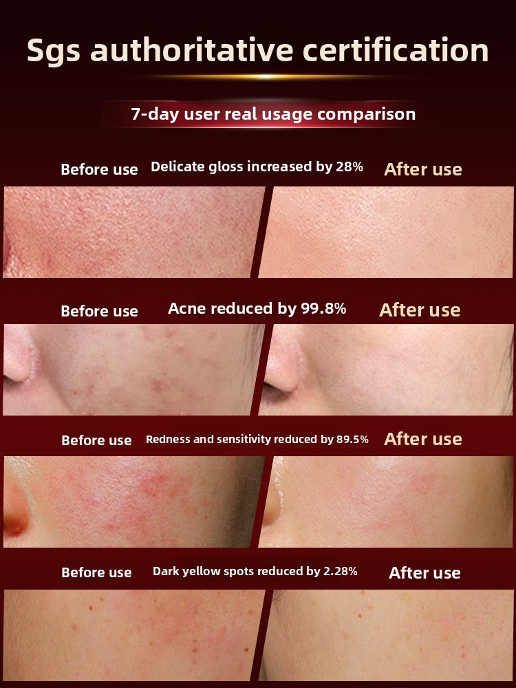 Photon Skin Rejuvenation LED Light Therapy Mask