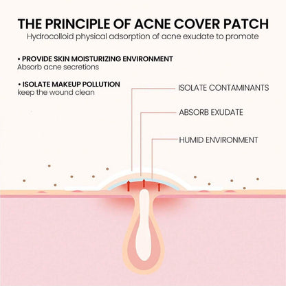 Pimples stickers