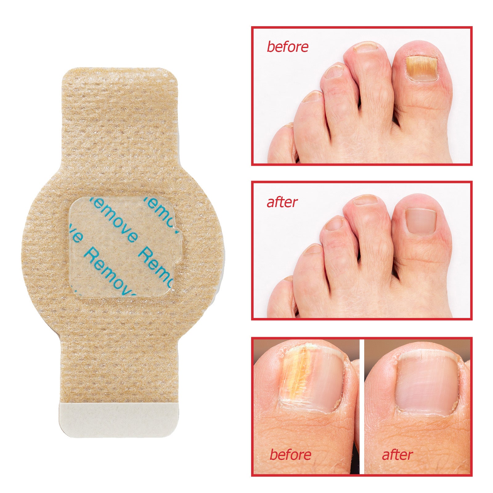 Pull paste nail groove inflammation nail protection paste