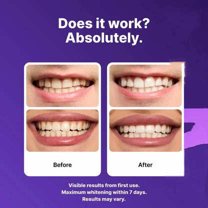 Purple Teeth Whitening Strips