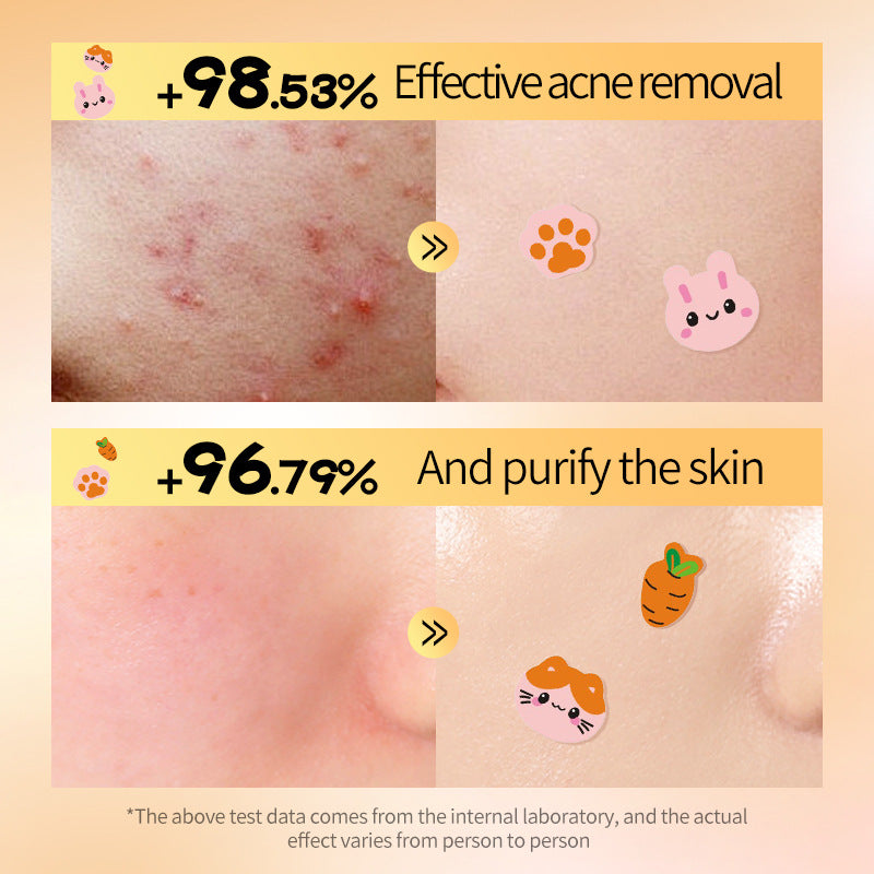 Rabbit and Cat Acne Patches 40 Pieces Acne Patches