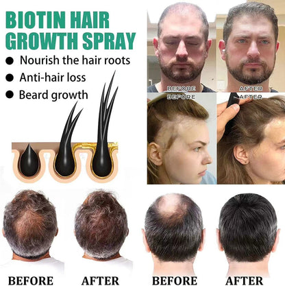 RALU Hair Growth Essence