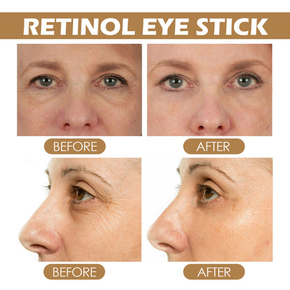 Retinol Eye Cream Stick