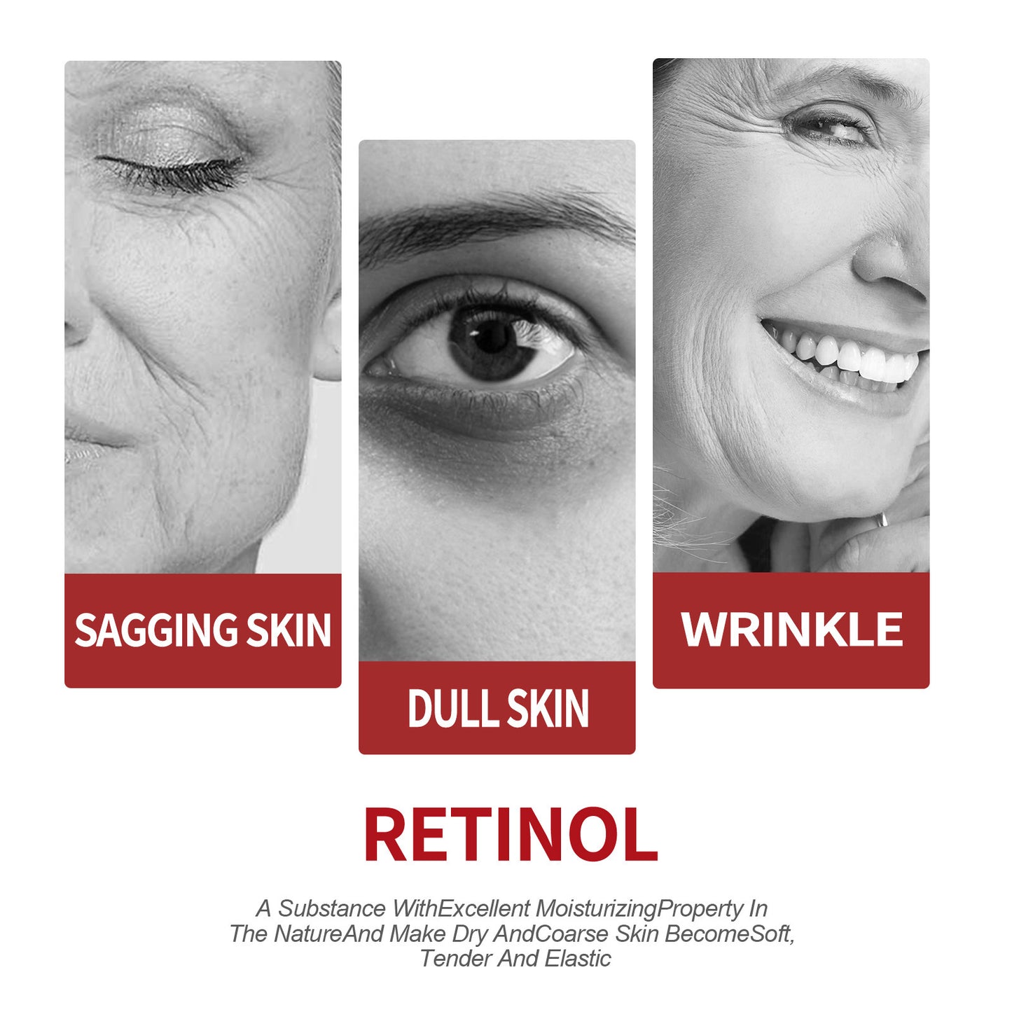 Retinol moisturizing cream