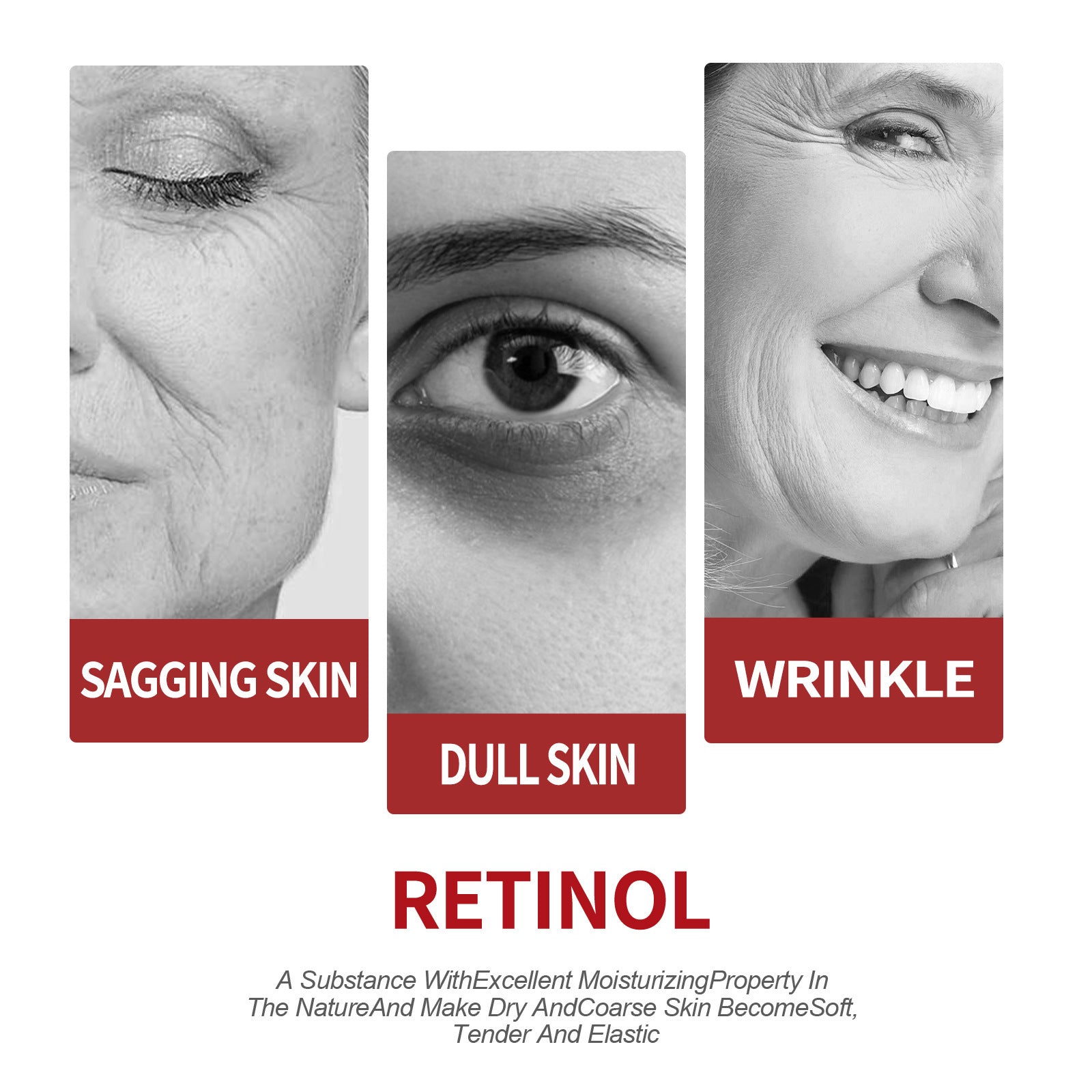 Retinol moisturizing cream