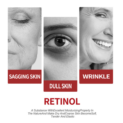 Retinol moisturizing cream