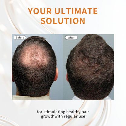 Rosemary Grape Seed Hair Oil