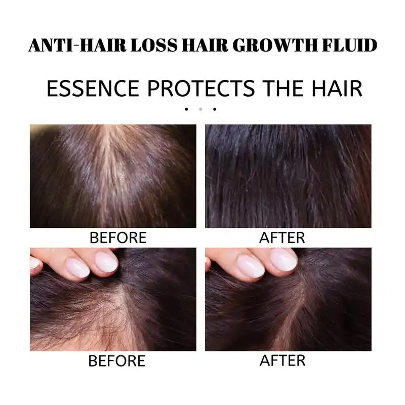 Rosemary Hair Growth Oil