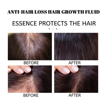 Rosemary Hair Growth Oil
