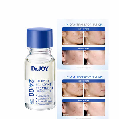 Salicylic acid Acne Essence