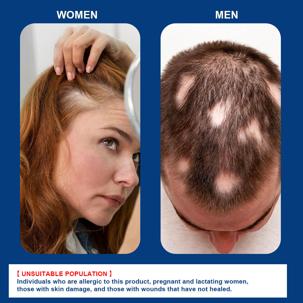 Scalp care cream