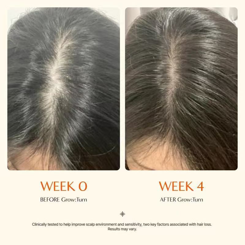 Scalp Care Essence