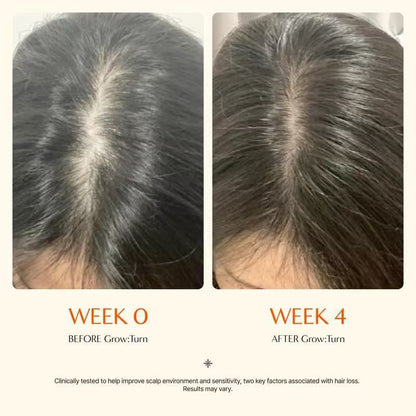 Scalp Care Essence