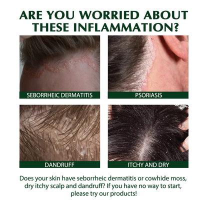 Scalp Care Shampoo