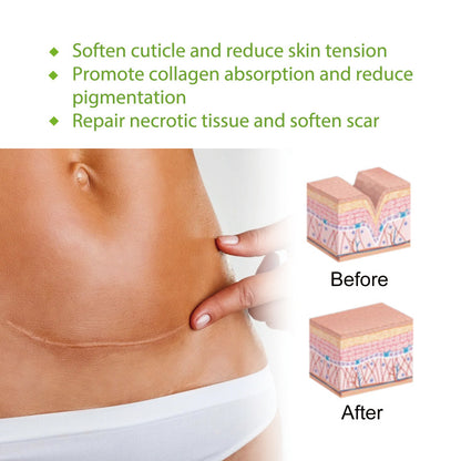 Silicone gel scar patch