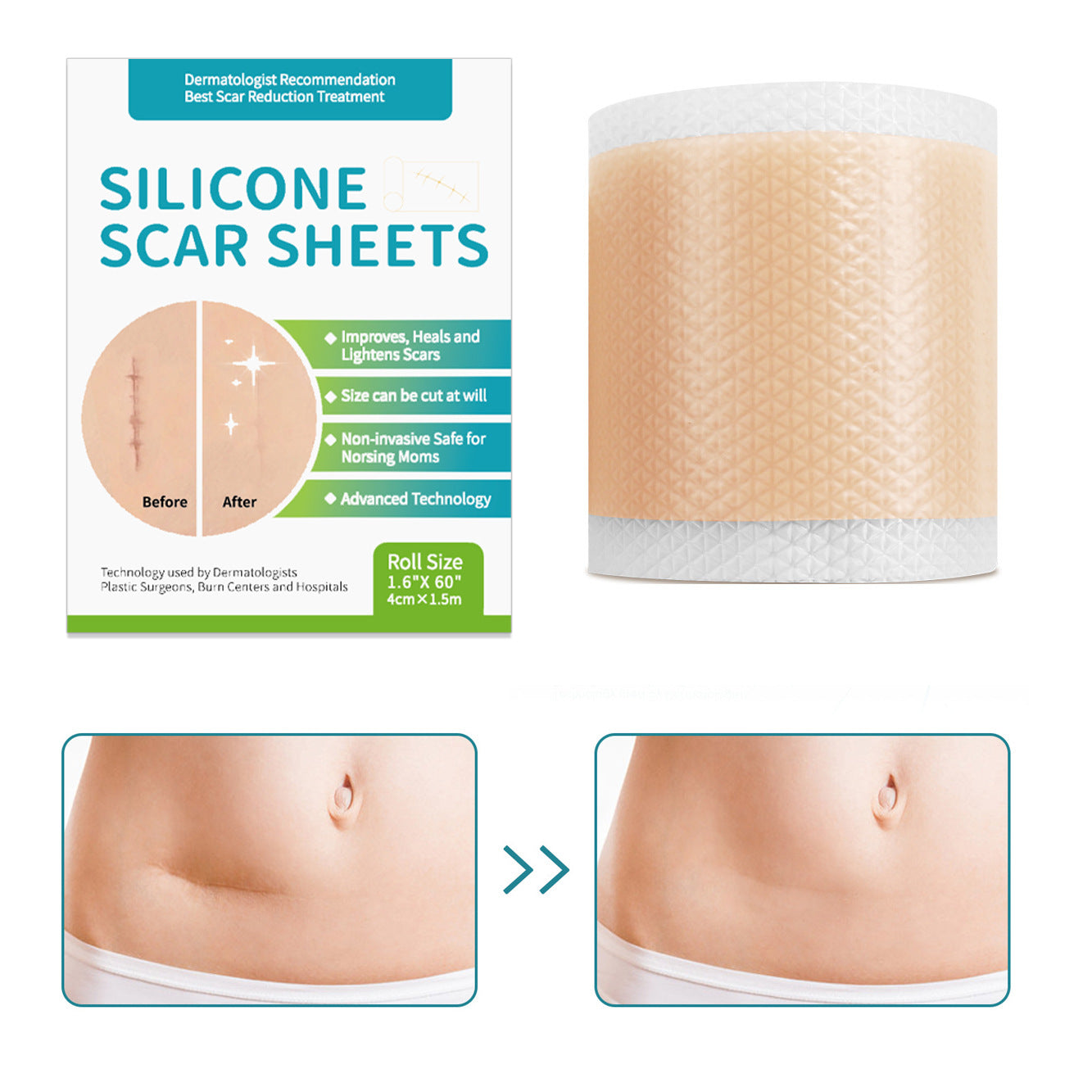 Silicone gel self-adhesive scar patch