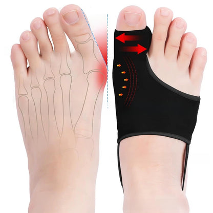 Silicone Hallux Valgus Corrector
