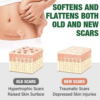 Silicone scar patch tape