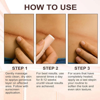 Silicone Scar Stick
