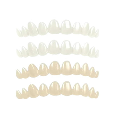 Simulation teeth braces
