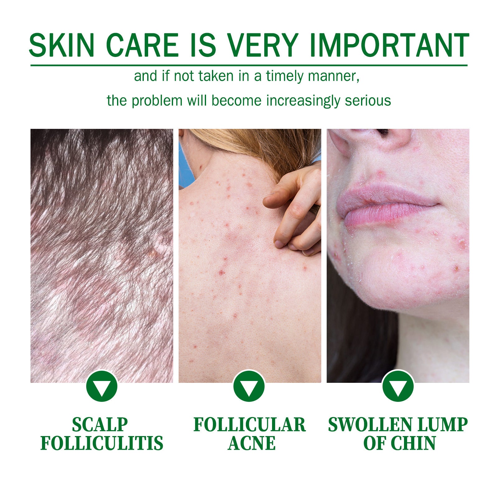 Skin Care Cream