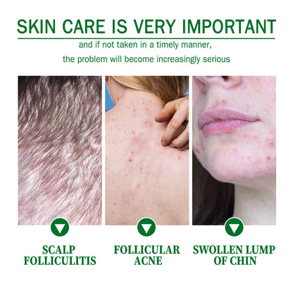 Skin Care Cream