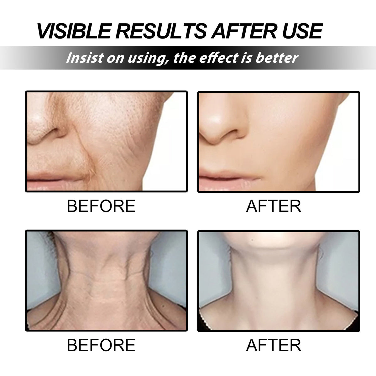 Skin Care Cream