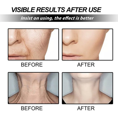 Skin Care Cream