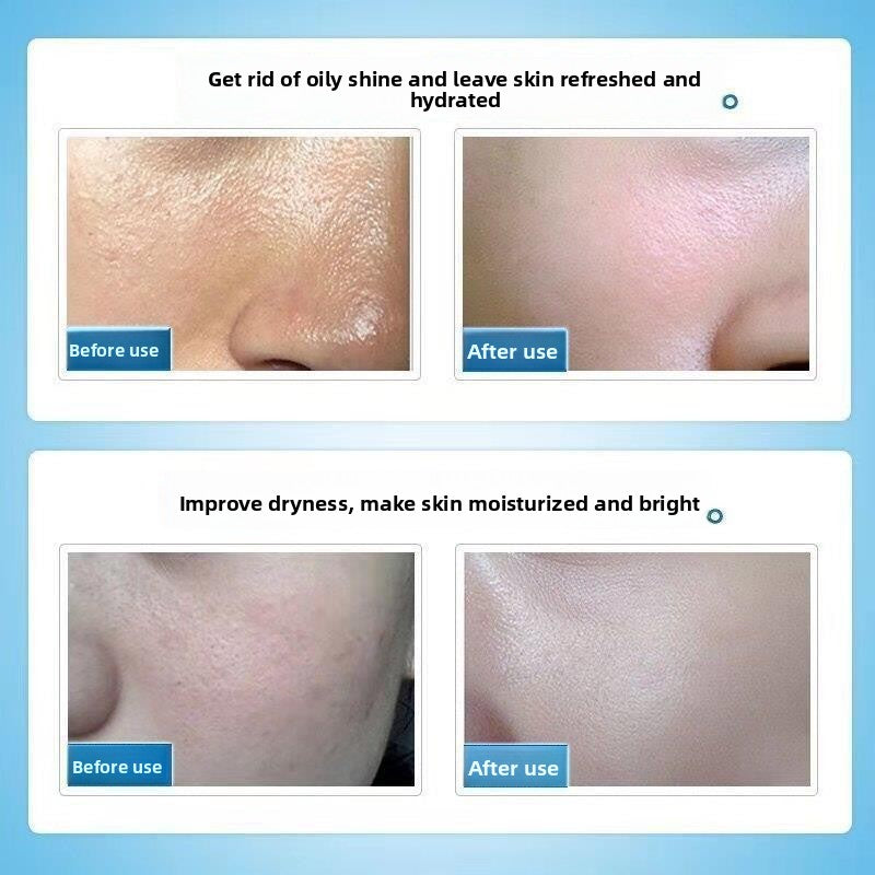 Skin Care Essence