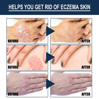 Skin care spray