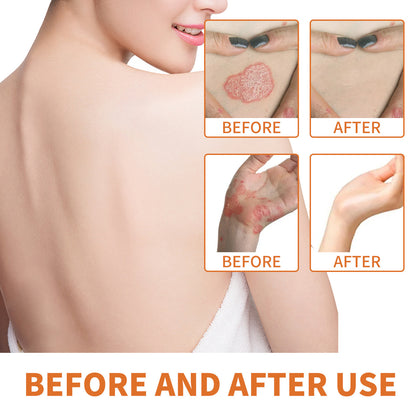 Skin care topical cream