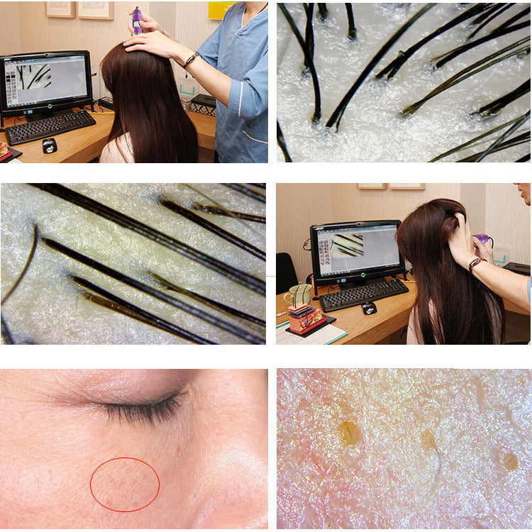 skin detection instrument