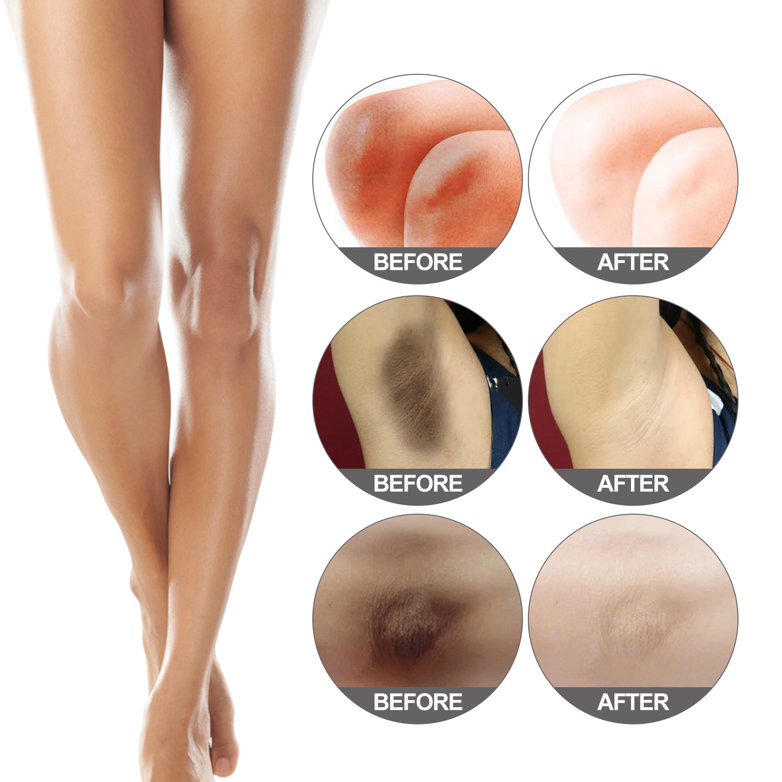 skin whitening cream