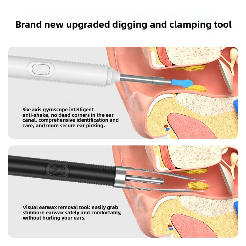 Smart Visual Earpick