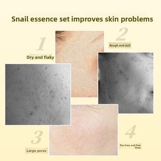 Snail Skincare Set