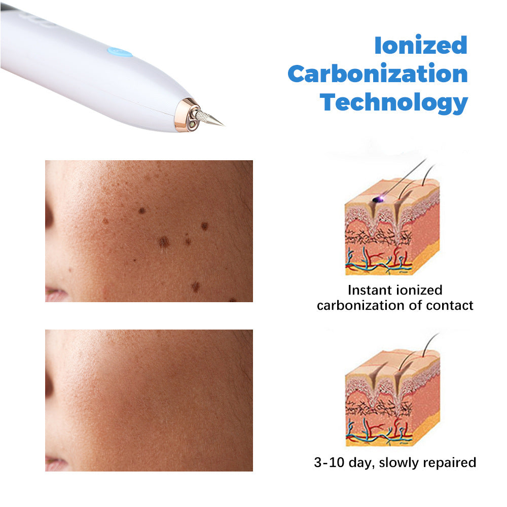 Tattoo removal plasma freckle removal machine