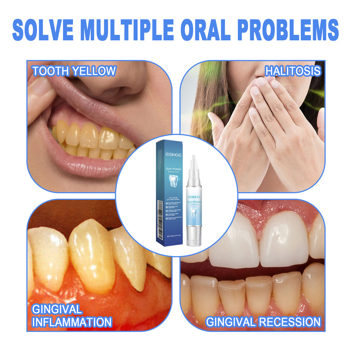 Teeth Whitening Gel