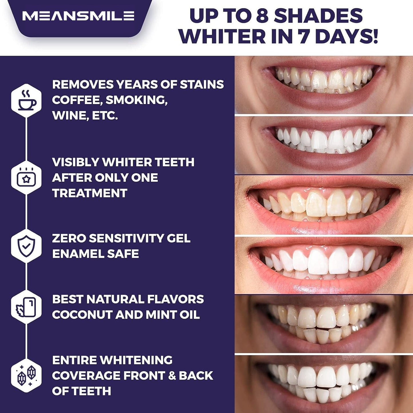 Teeth Whitening Strips