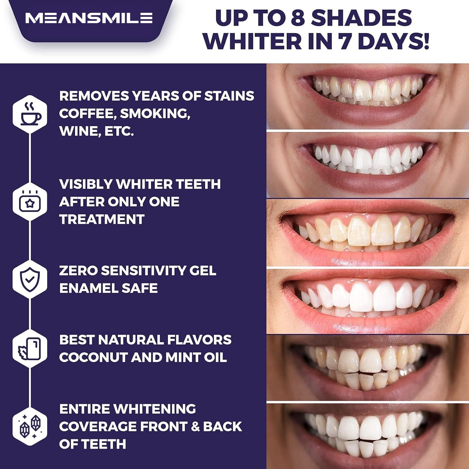 Teeth Whitening Strips