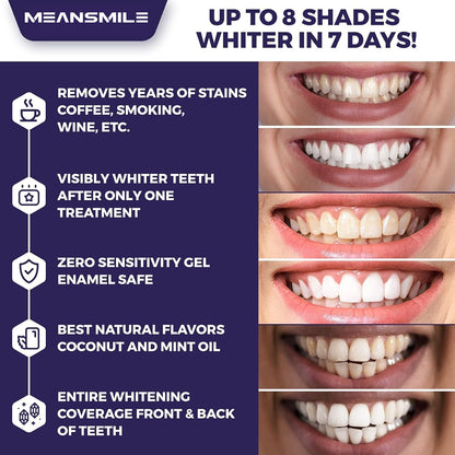 Teeth Whitening Strips