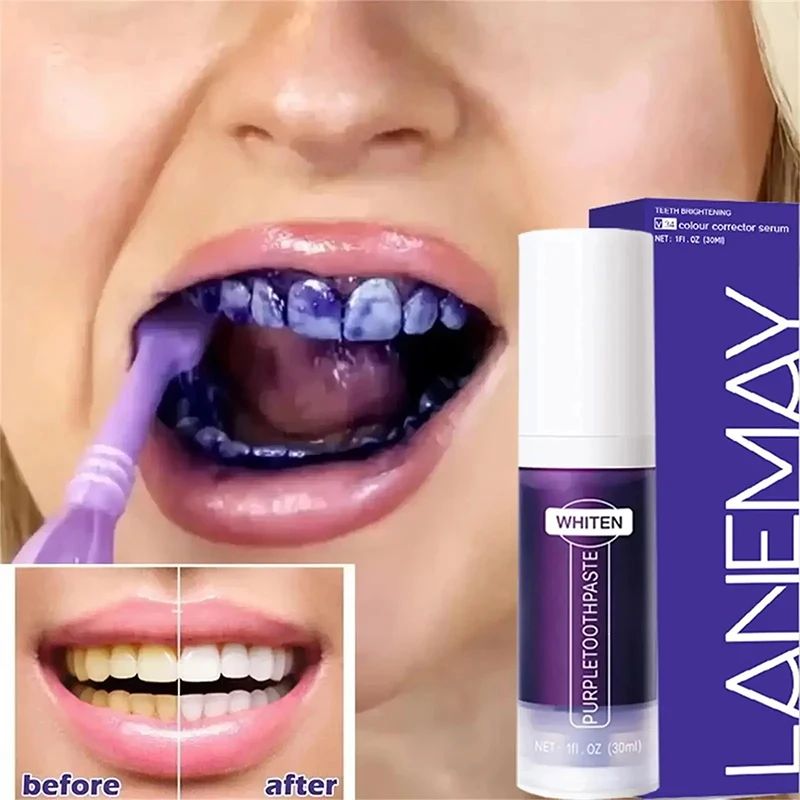 Teeth Whitening Toothpaste with Stain Removal