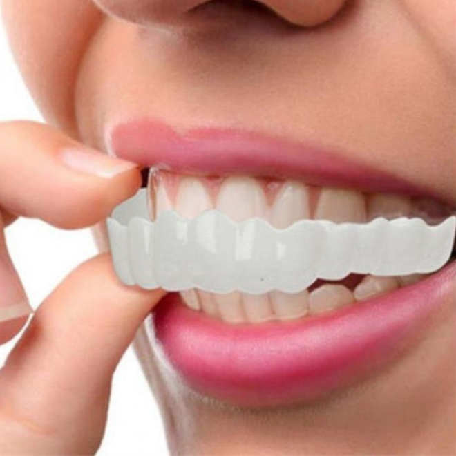 Temporary Dental Braces for Teeth