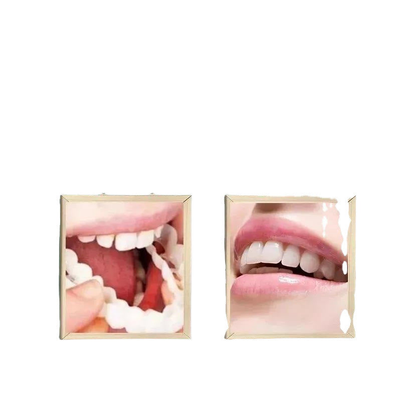 Temporary Dental Braces for Teeth