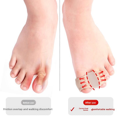 Toe Separator Orthosis