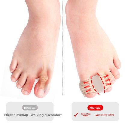 Toe separator
