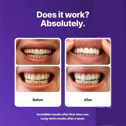 Toothpaste