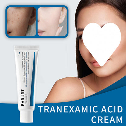 Tranexamic Acid Cream for Chloasma and Moisturizing